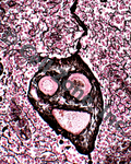 Reticular Connective Tissue that looks like a face