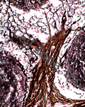 Reticular Connective Tissue that looks like a tree